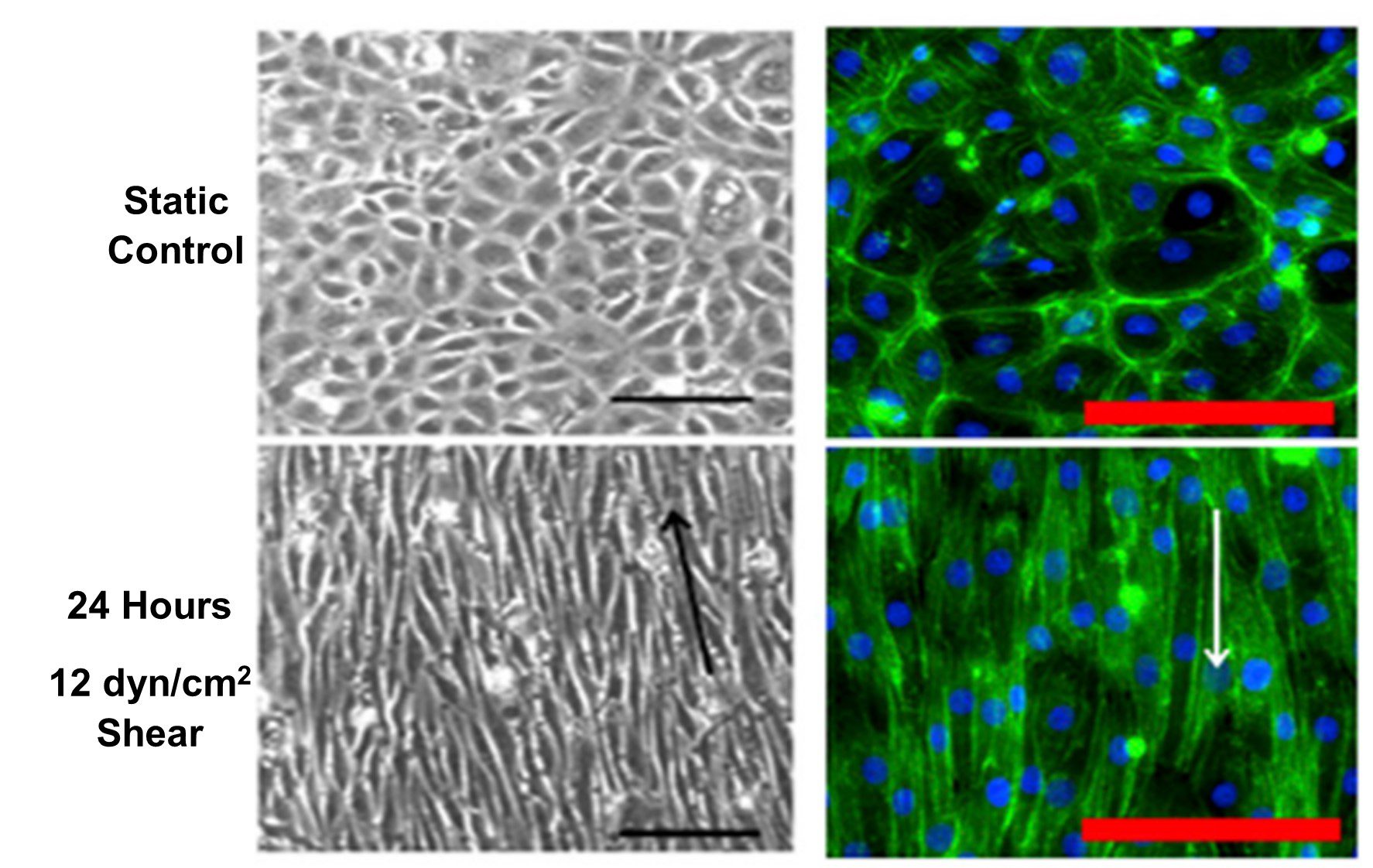 shear stress induced endothelial cell alignment
