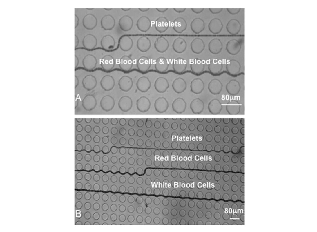 Deterministic lateral displacement for particle separation